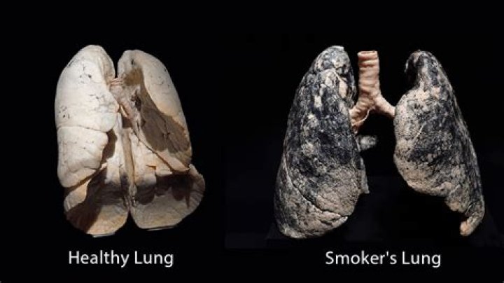 Can lungs heal after 20 years of smoking?
