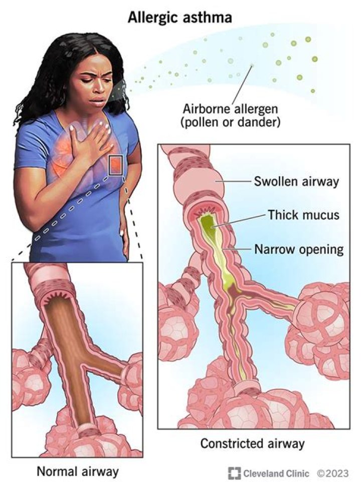 Does heat make asthma worse?