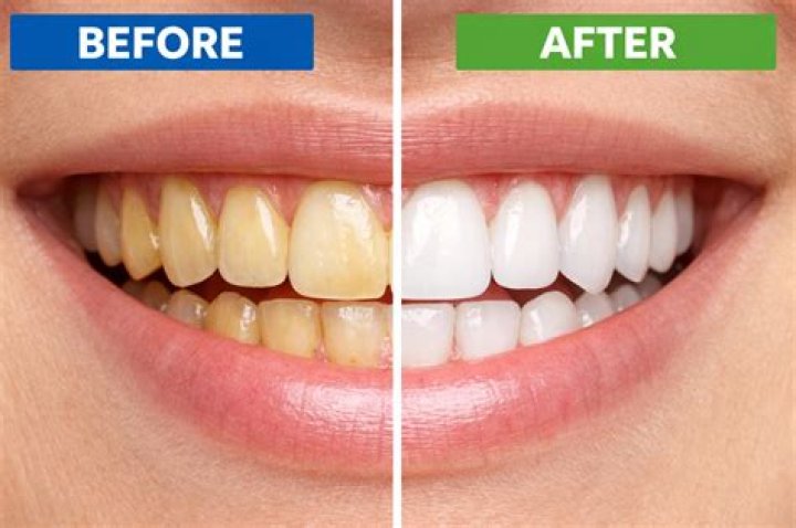 How do I keep coffee from turning my teeth yellow?