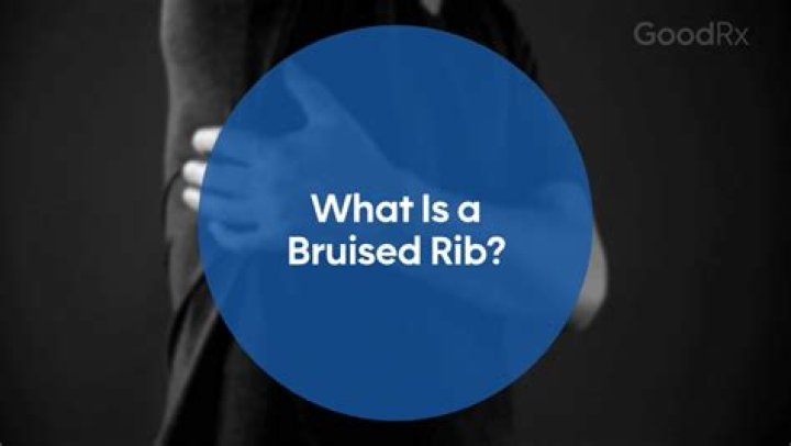 Is a bruised rib bad?