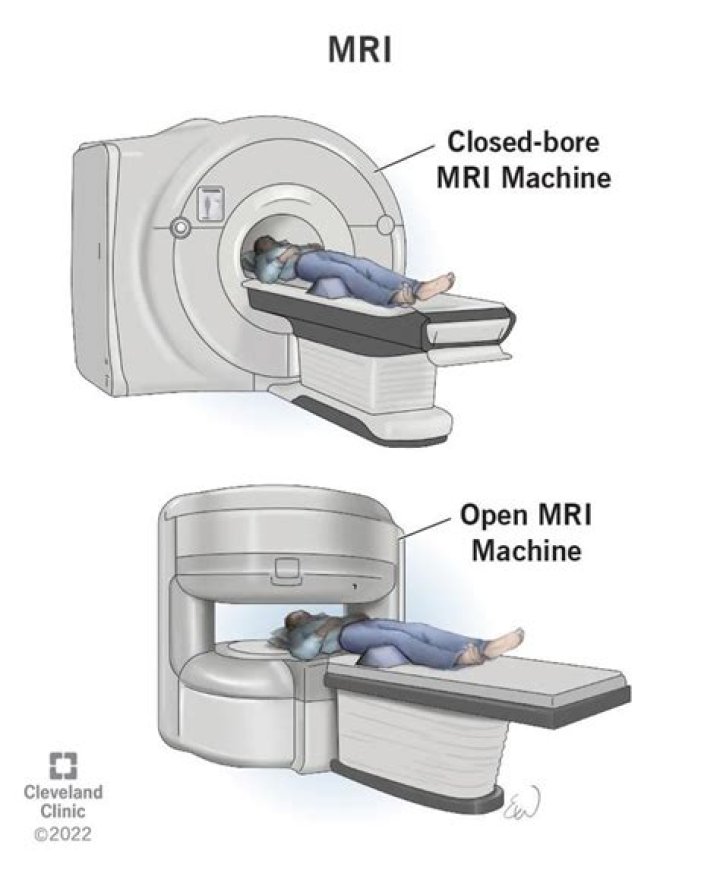 Is there an alternative to an MRI?
