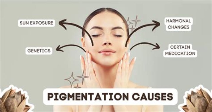 What are the main causes of pigmentation?