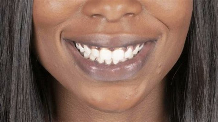 What color are black people's gums?