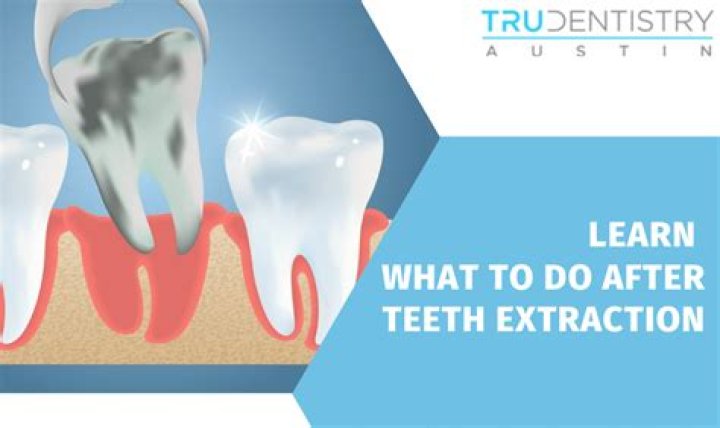 What does dentist do after tooth extraction?