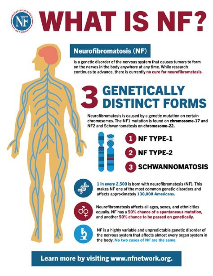What does NF2 look like?