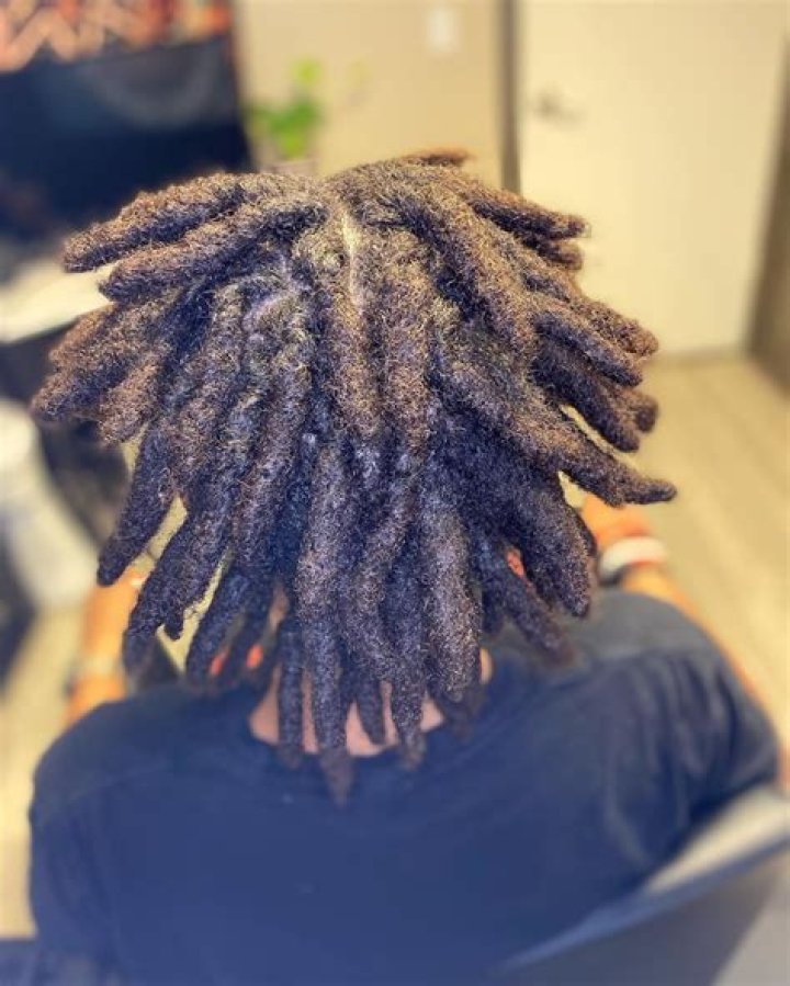 Why do my starter locs itch?